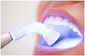 clareamento dental a laser