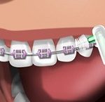 escova interdental
